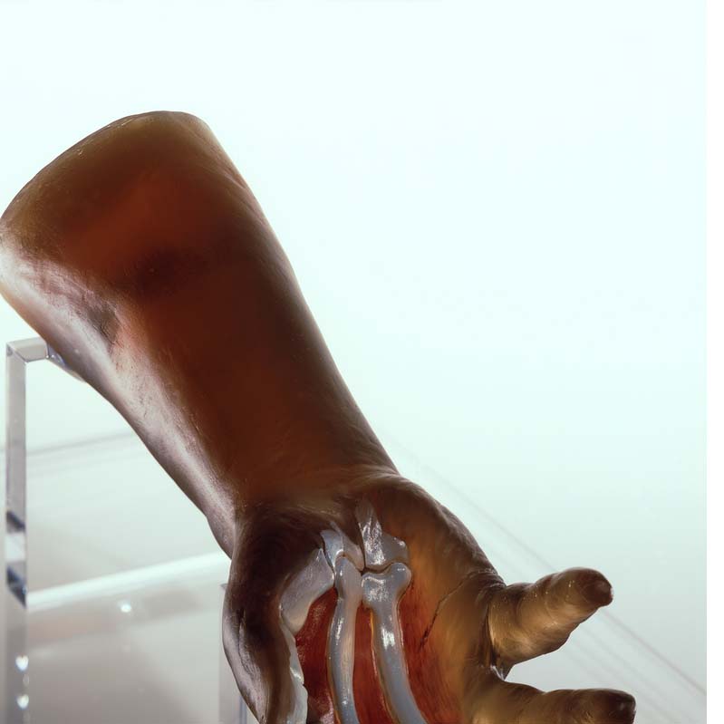Sculpture of a translucent, dark red hand lying palm side up on a clear plinth where three of the fingers have exposed bones