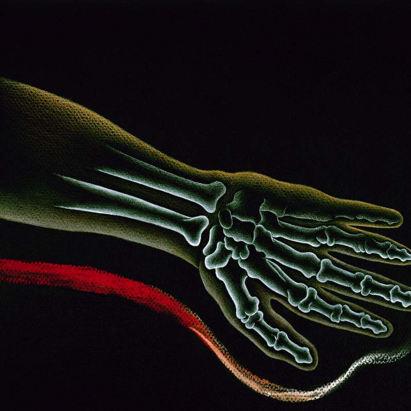 Drawing in yellow, white, and red on black of an outstretched hand with exposed bones
