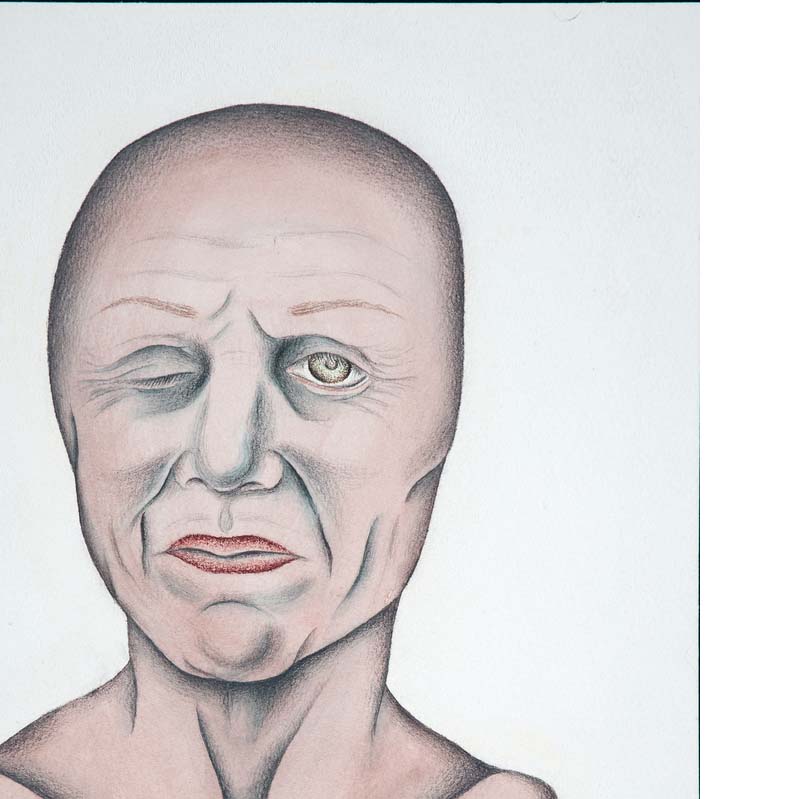 Drawing in shades of pink, black, and red of a bald face with one eye closed